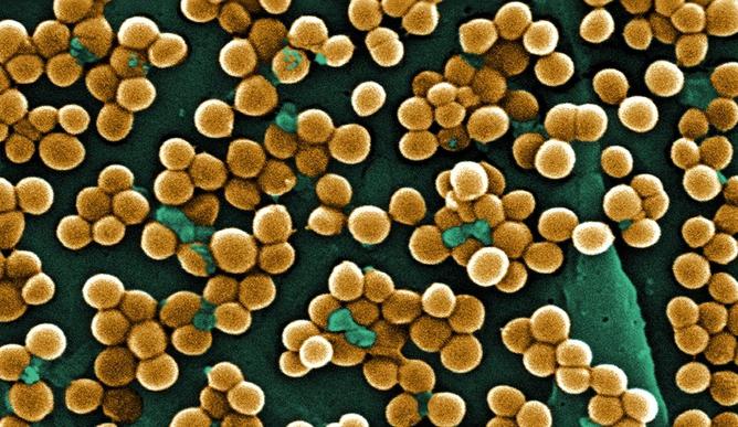 Staphylococcus v grlu pri otrocih