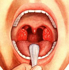 streptocid per il trattamento della gola