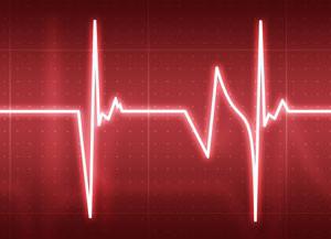 come trattare l'aritmia cardiaca
