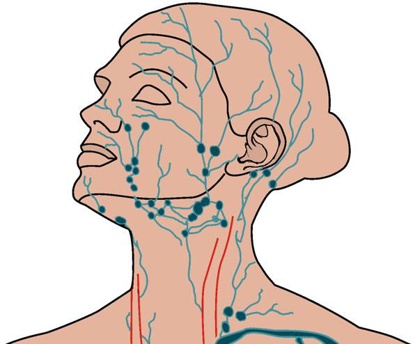 zánět lymfatických uzlin kolem krku