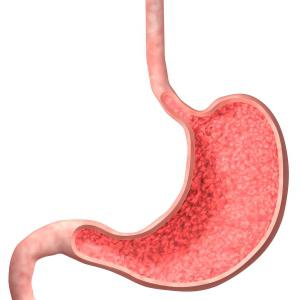 simptomi gastritisa z visoko kislostjo