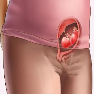 kakšni so simptomi ogroženega spontanega splava