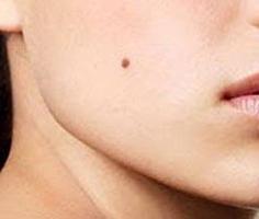vrednost molov na obrazu žensk