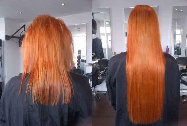 лента разширения коса преглежда снимки преди и след