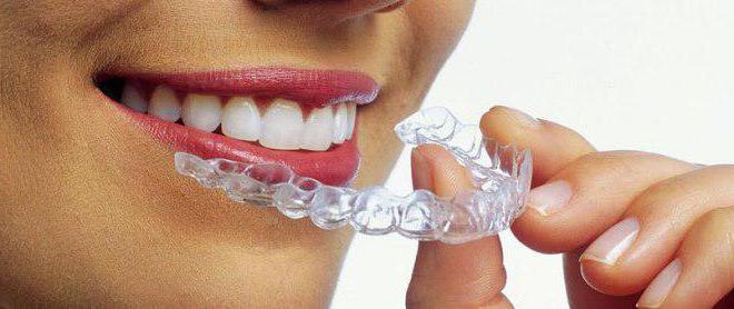 recensioni di tappo di allineamento dei denti trasparenti