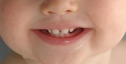 denti nei bambini