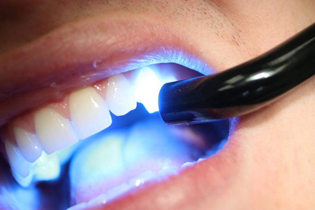 Izravna obnova zuba