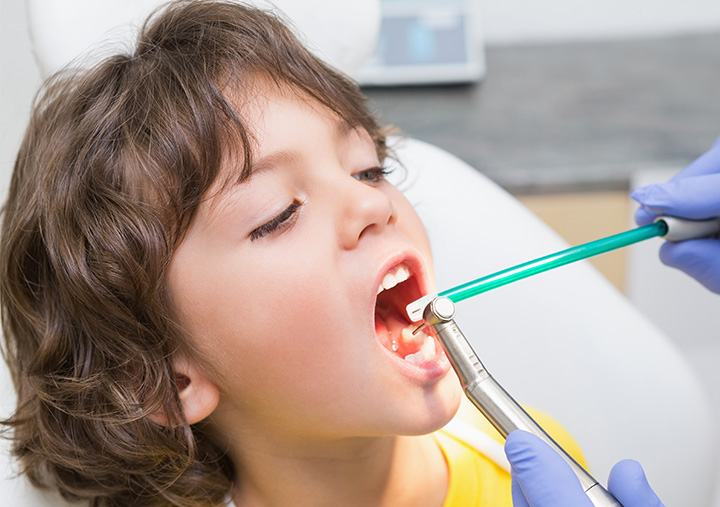 Estensione dei denti nei bambini