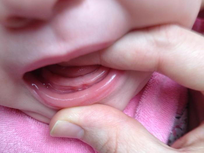 dentizione come aiutare le revisioni del bambino