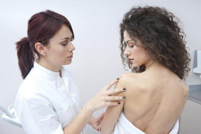 akne na hrbtni strani ženske, kako se znebiti