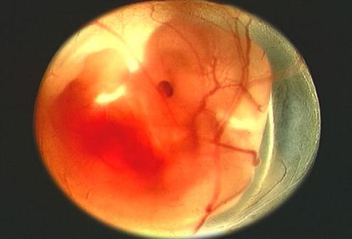 embrya při 9 týdnech gestace
