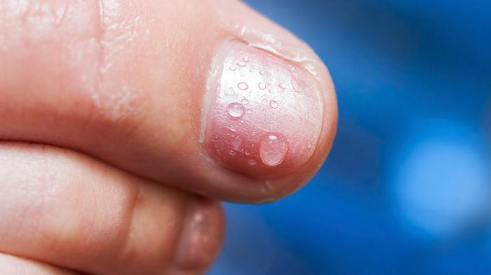 бифозин от гъбички на ноктите разглежда аналози