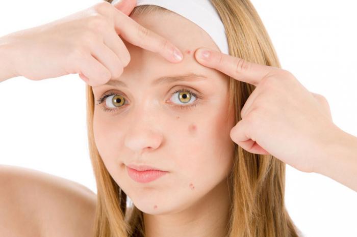 recensioni dell'acne del metrogil