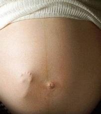 baby mescolando durante la gravidanza