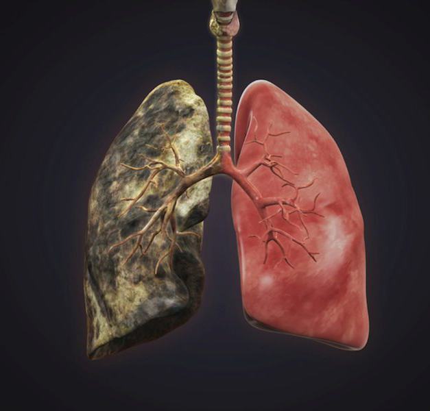 i polmoni del fumatore hanno 15 anni di esperienza