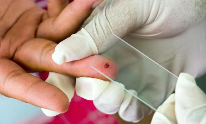 Пласмодиум маларија у крви