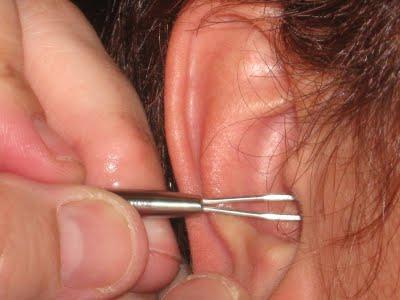 peeling v uších