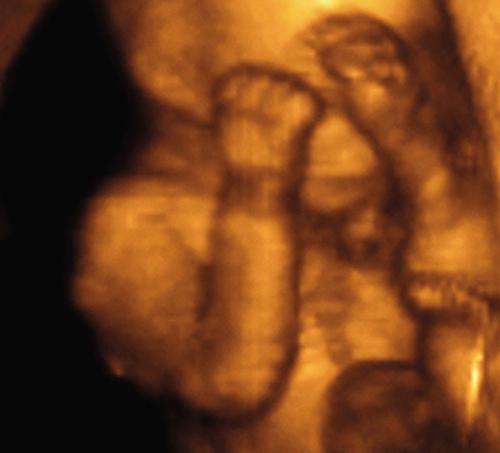 movimento del feto durante la seconda gravidanza per intero