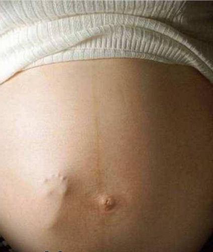 fetální pohyb během druhého těhotenství