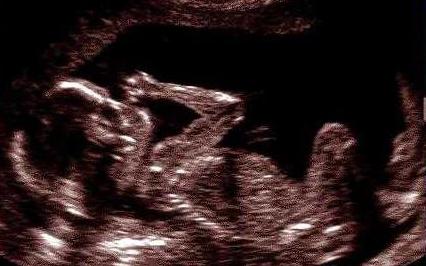 movimento del feto durante la prima gravidanza