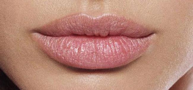 Oblika ustnic
