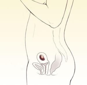 velikost maternice je normalna