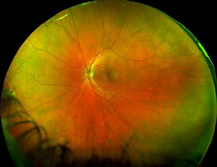 какви функции прави ретината