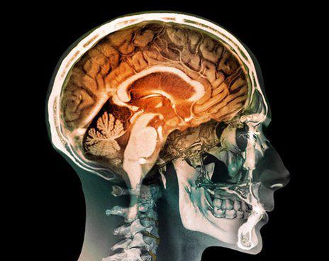 možganske strukture