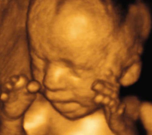 proč dělá třetí ultrazvuk během těhotenství
