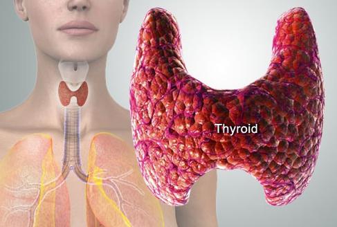 Trattamento di una ghiandola tiroidea ingrossata