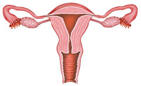 simptomi stekline maternice pri ženskah