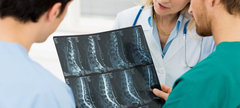 Metodi di diagnosi dell'osteocondrosi cervicale