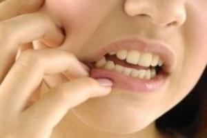 przeciwbólowy ból zęba