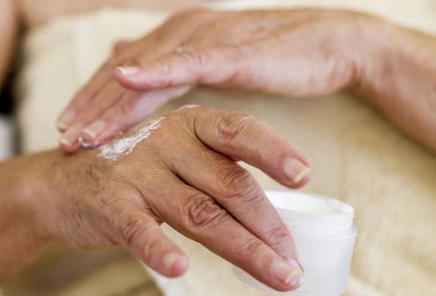 come curare l'eczema sulle mani