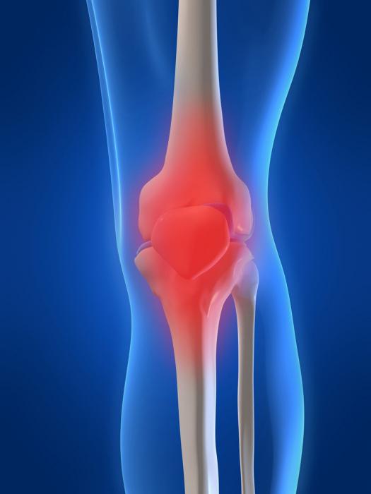 tekućina se nakuplja u zglobu koljena i boli
