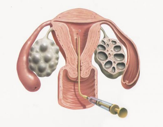 ovulacija sproži, kaj je to