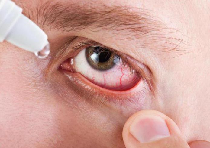 oční kapky tropicamidu