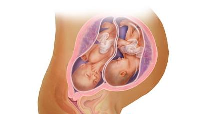 36 tjedana trudnoće blizanci