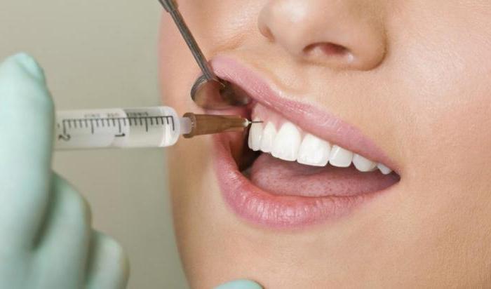 anestesia in odontoiatria