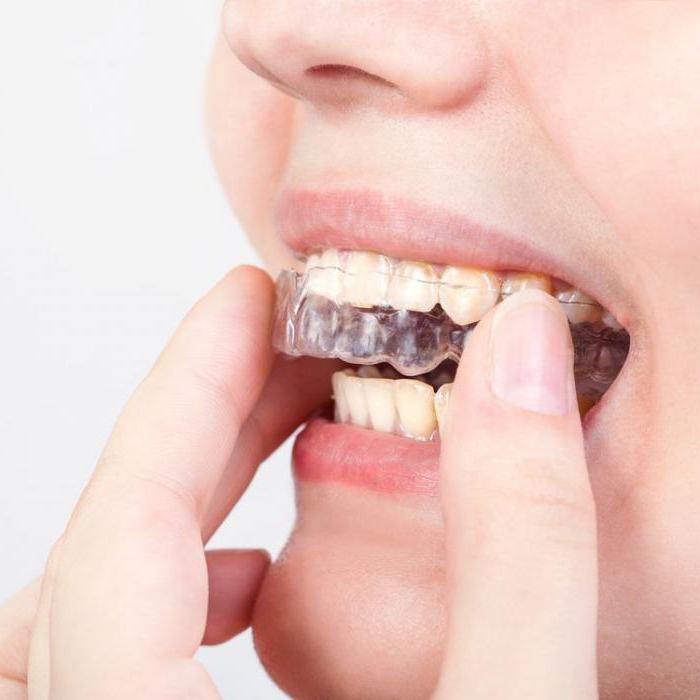 typy zubů u lidí