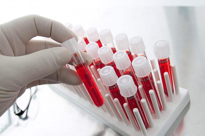 vrste krvnih testova