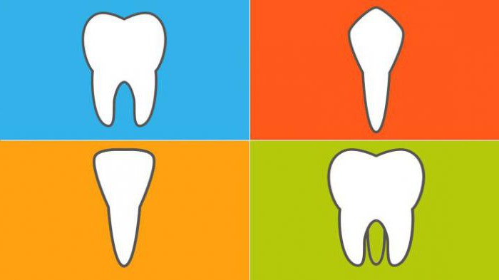 typy zubních implantátů