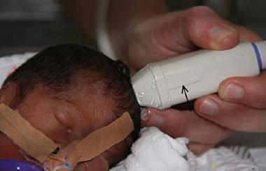 Ultrazvuk mozku novorozenecké normy