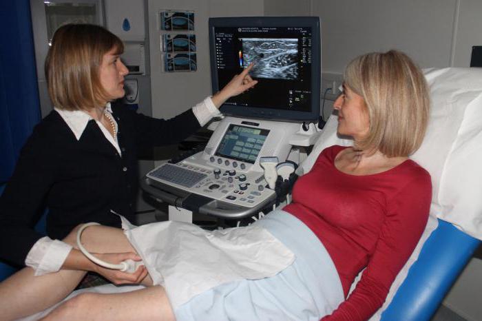 ultrazvok žil spodnjih okončin