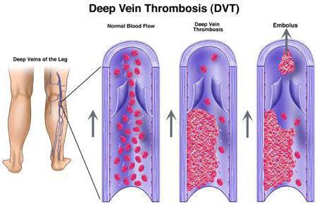 obavite ultrazvuk krvnih žila donjih udova