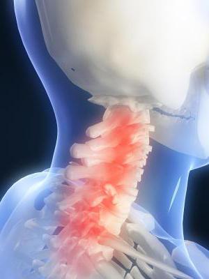 artroza unco vertebral