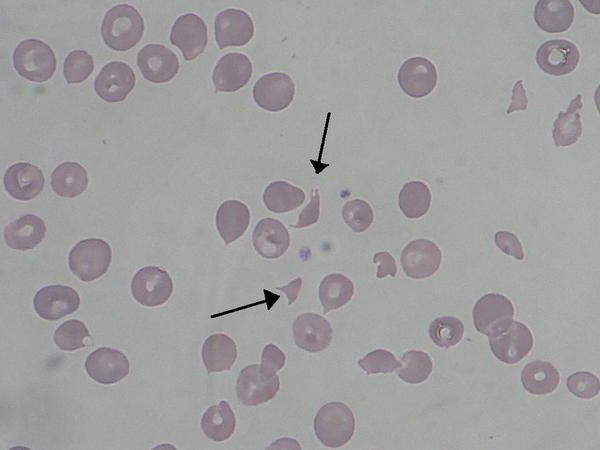 Ureaplasma в мъж снимка