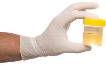 analizo urina po sulkovichi, kako se zbirajo