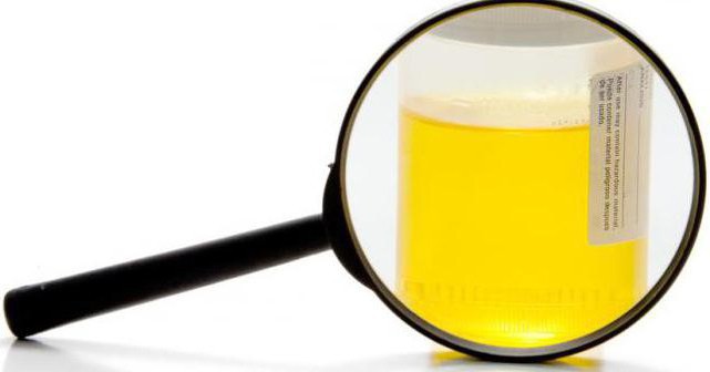 kako jemati analizo urina na sulkovichu