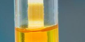 analiza urina od strane sulkovicha je negativna
